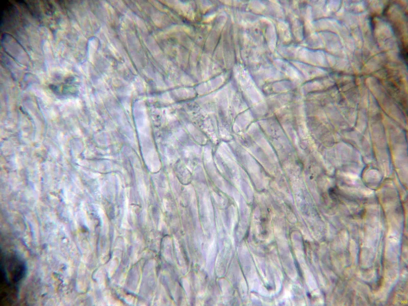 Cenangium ferruginosum 10 - Excípulo agua-002